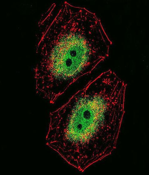 BCL6 Antibody in Immunocytochemistry (ICC/IF)