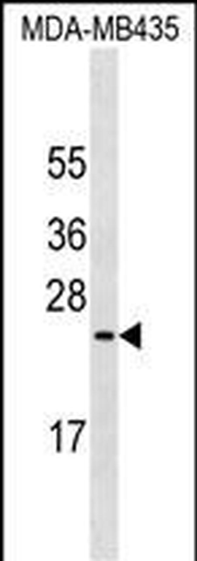 MUC1 Antibody in Western Blot (WB)