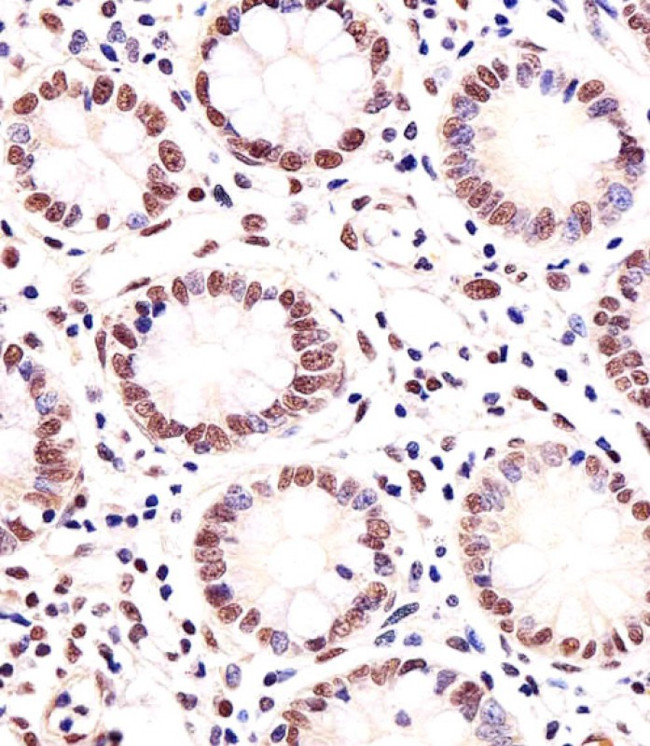 MGMT Antibody in Immunohistochemistry (Paraffin) (IHC (P))