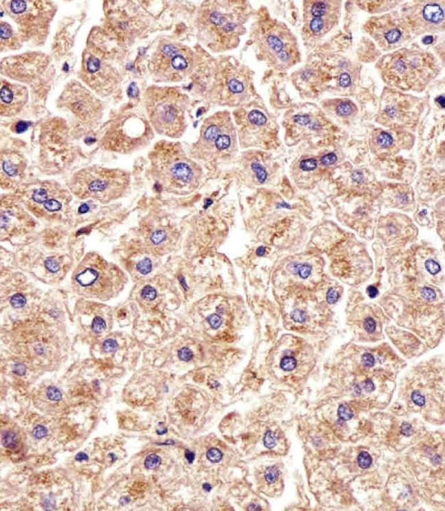 CTSD Antibody in Immunohistochemistry (Paraffin) (IHC (P))
