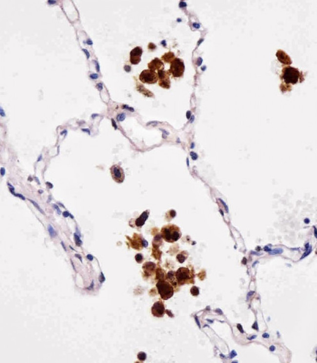 FABP4 Antibody in Immunohistochemistry (Paraffin) (IHC (P))