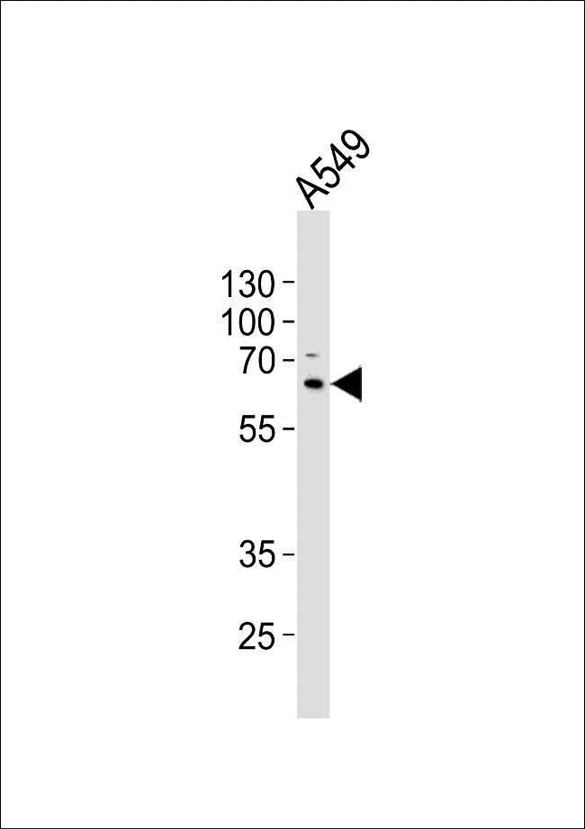 SQSTM1 Antibody in Western Blot (WB)