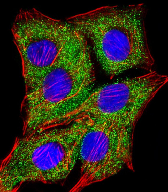 TIMP2 Antibody in Immunocytochemistry (ICC/IF)