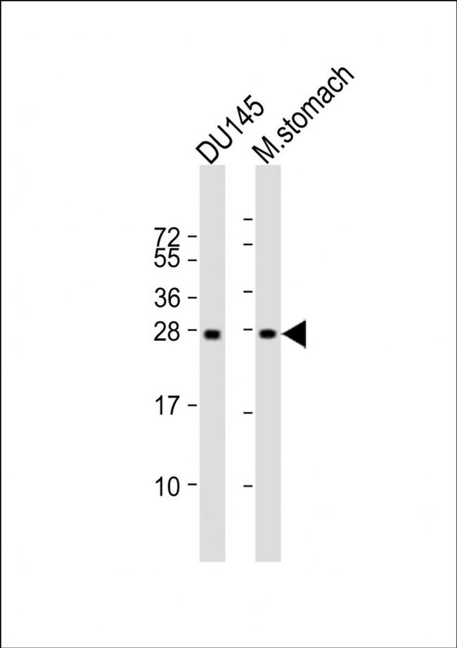 RAB27B Antibody in Western Blot (WB)