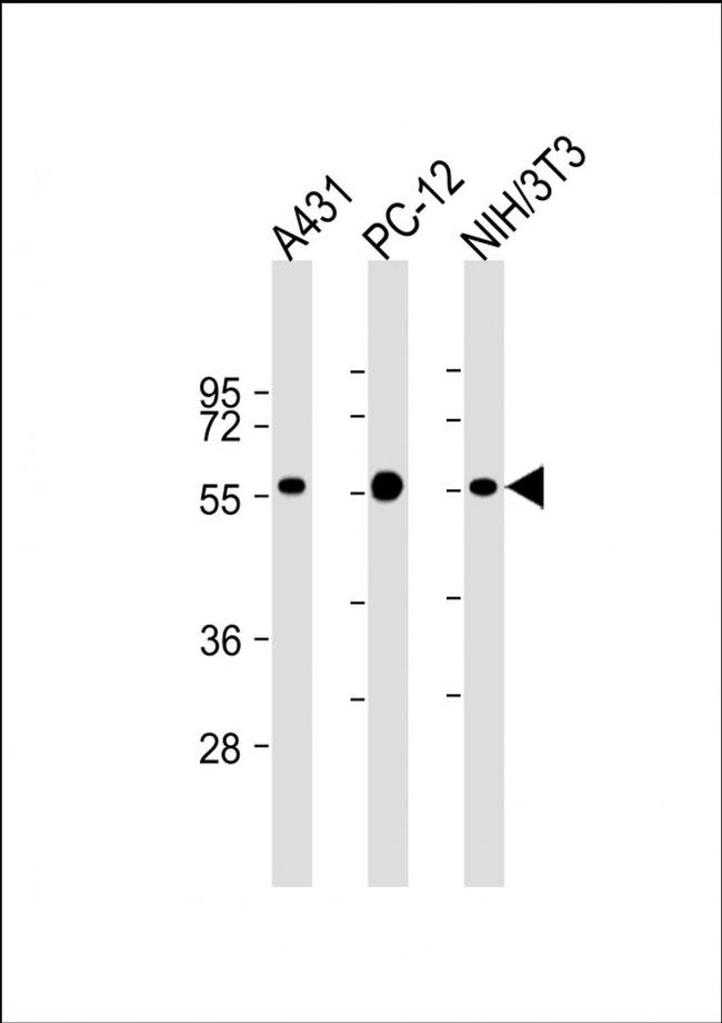 MITF Antibody in Western Blot (WB)