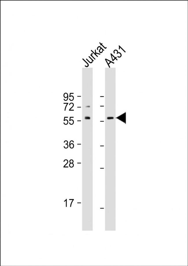 SRC Antibody in Western Blot (WB)
