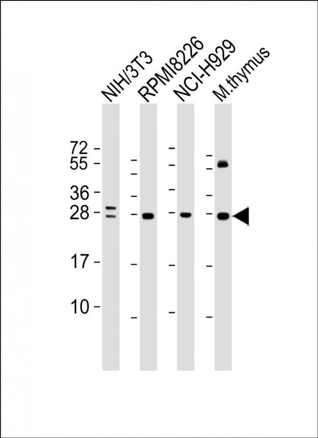 FGFR1OP2 Antibody in Western Blot (WB)