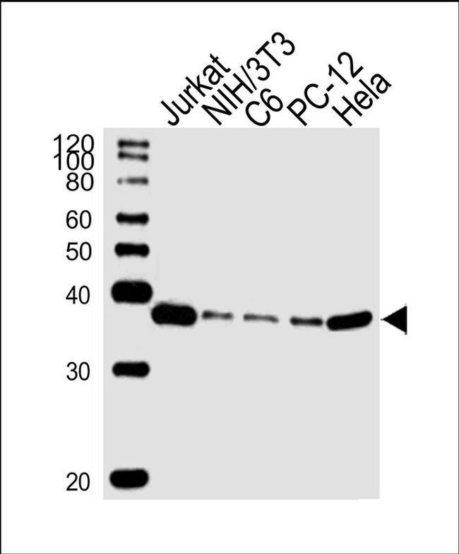 RAD51 Antibody in Western Blot (WB)