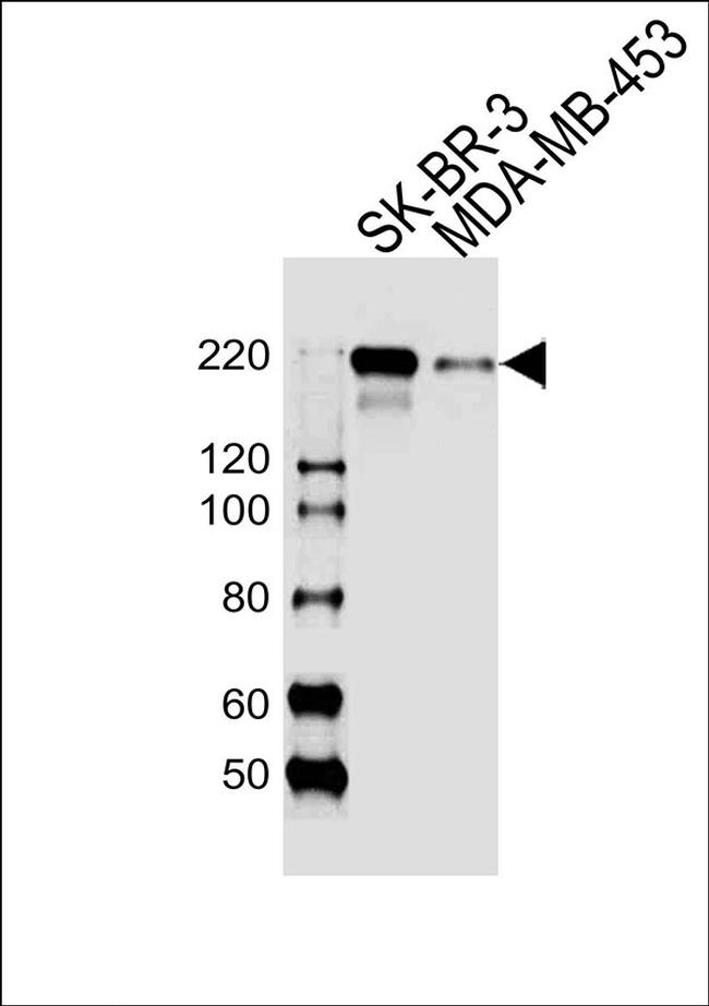 ERBB2 Antibody in Western Blot (WB)