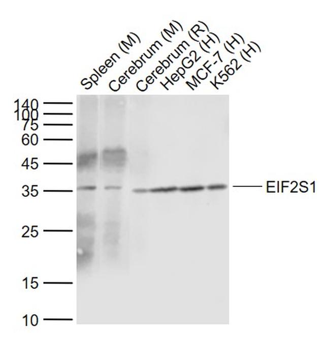 EIF2S1 Antibody in Western Blot (WB)