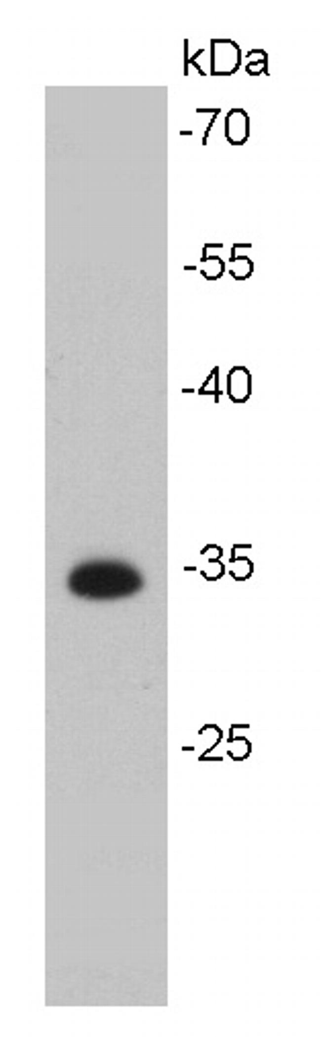 Cdk4 Antibody in Western Blot (WB)