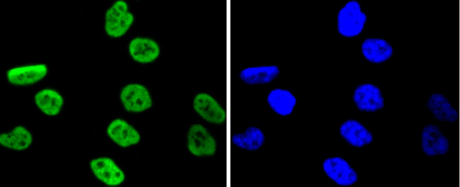 Phospho-MSK1 (Ser376) Antibody in Immunocytochemistry (ICC/IF)