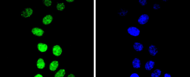 Phospho-Cyclin E1 (Thr77) Antibody in Immunocytochemistry (ICC/IF)