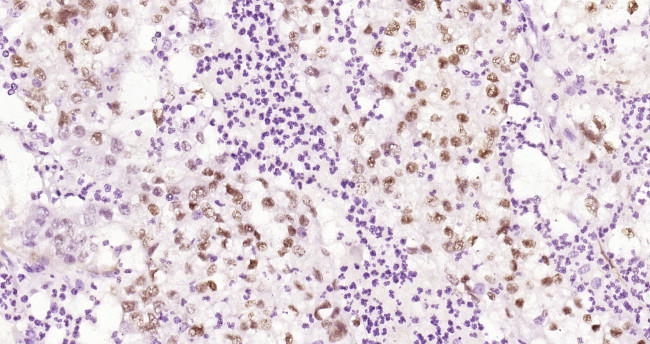 Phospho-HSF1 (Ser326) Antibody in Immunohistochemistry (Paraffin) (IHC (P))