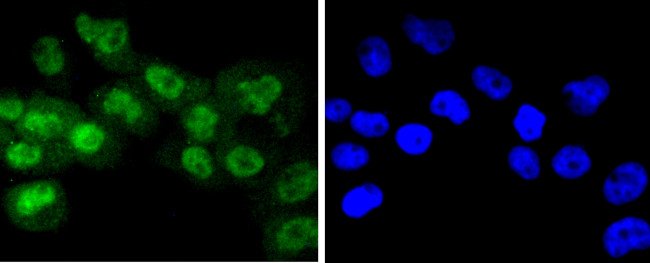 Phospho-RSK1 p90 (Thr359, Ser363) Antibody in Immunocytochemistry (ICC/IF)