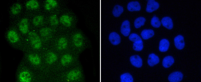 Phospho-Smad3 (Ser423, Ser425) Antibody in Immunocytochemistry (ICC/IF)