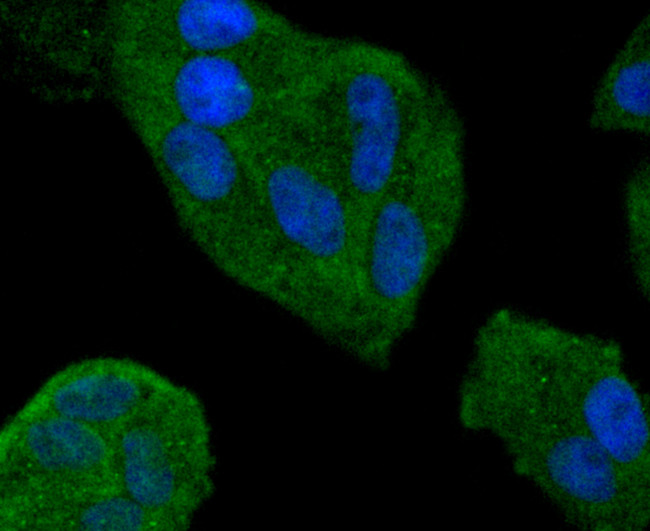 Smad4 Antibody in Immunocytochemistry (ICC/IF)