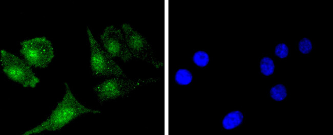 BCL2 Antibody in Immunocytochemistry (ICC/IF)