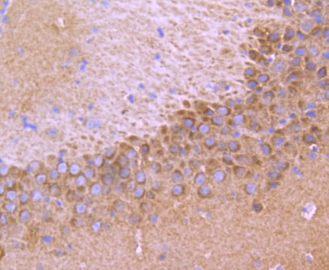 TrkA+B+C Antibody in Immunohistochemistry (Paraffin) (IHC (P))