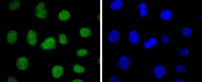 SUZ12 Antibody in Immunocytochemistry (ICC/IF)