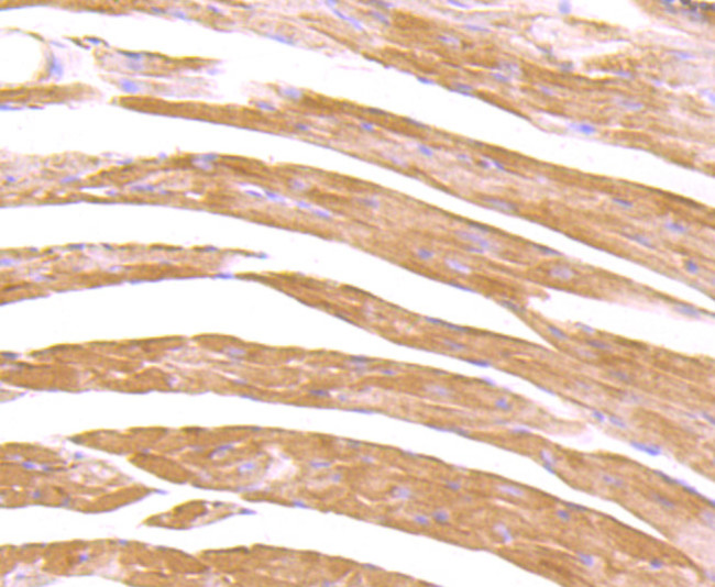 CXCR5 Antibody in Immunohistochemistry (Paraffin) (IHC (P))