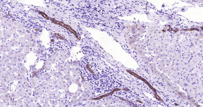 CYP26A1 Antibody in Immunohistochemistry (Paraffin) (IHC (P))