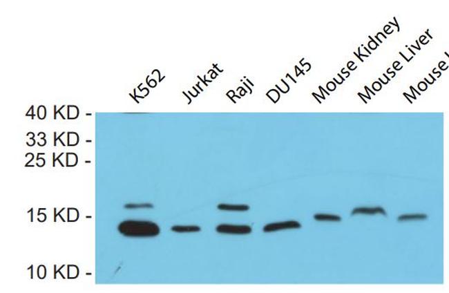 FRATAXIN Antibody in Western Blot (WB)