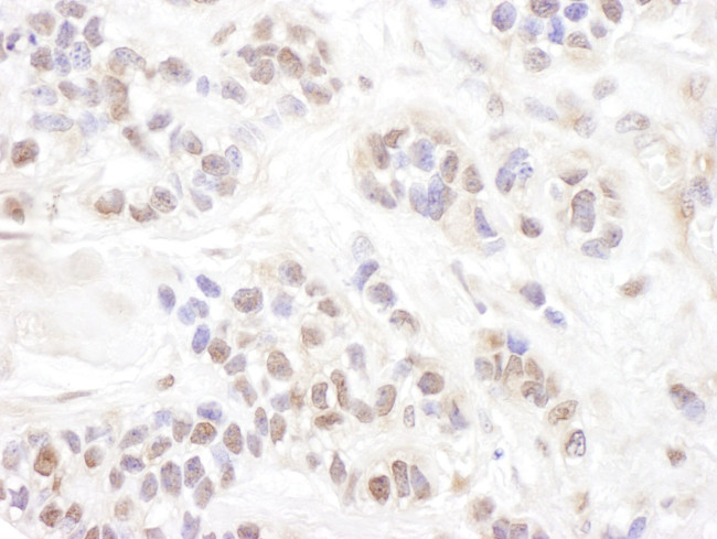 c-Myb Antibody in Immunohistochemistry (IHC)