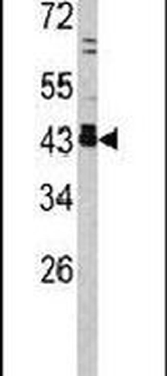 c-Fos Antibody in Western Blot (WB)