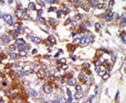 cGKI Antibody in Immunohistochemistry (IHC)