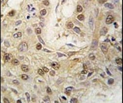 cGKII Antibody in Immunohistochemistry (IHC)
