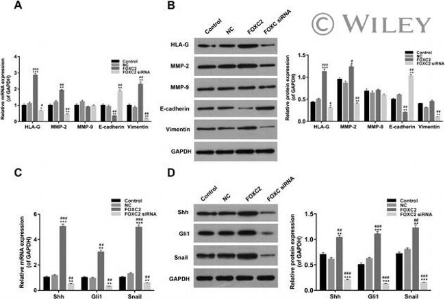SHH Antibody in Western Blot (WB)