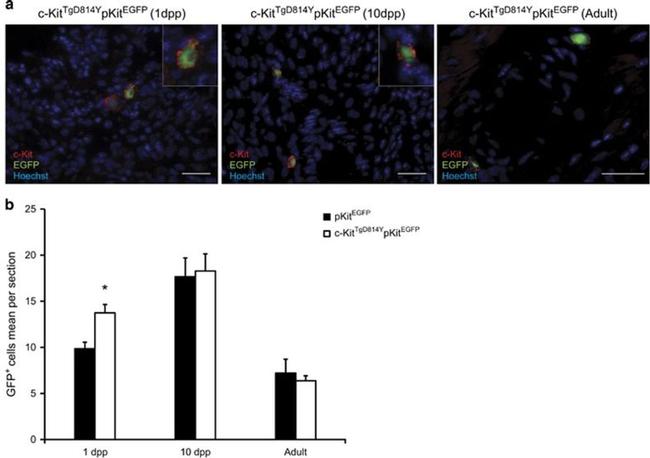 c-Kit Antibody in Immunohistochemistry (IHC)