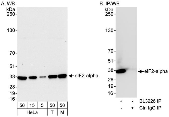 eIF2alpha/EIF2S1 Polyclonal Antibody (A300-721A)