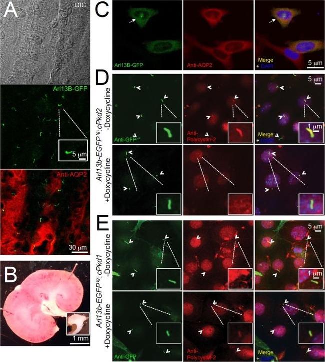 PKD2 Antibody in Immunocytochemistry (ICC/IF)