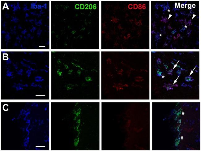 CD86 (B7-2) Antibody in Immunohistochemistry (IHC)
