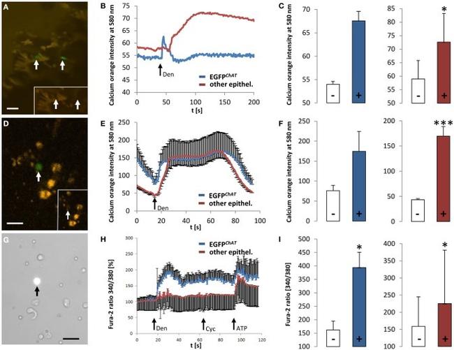 eGFP Antibody in Immunohistochemistry (IHC)
