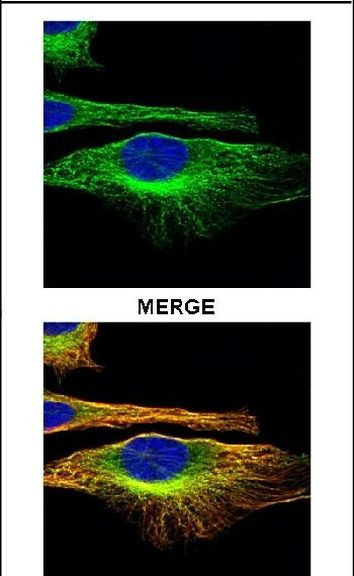 Actin Antibody in Immunocytochemistry (ICC/IF)