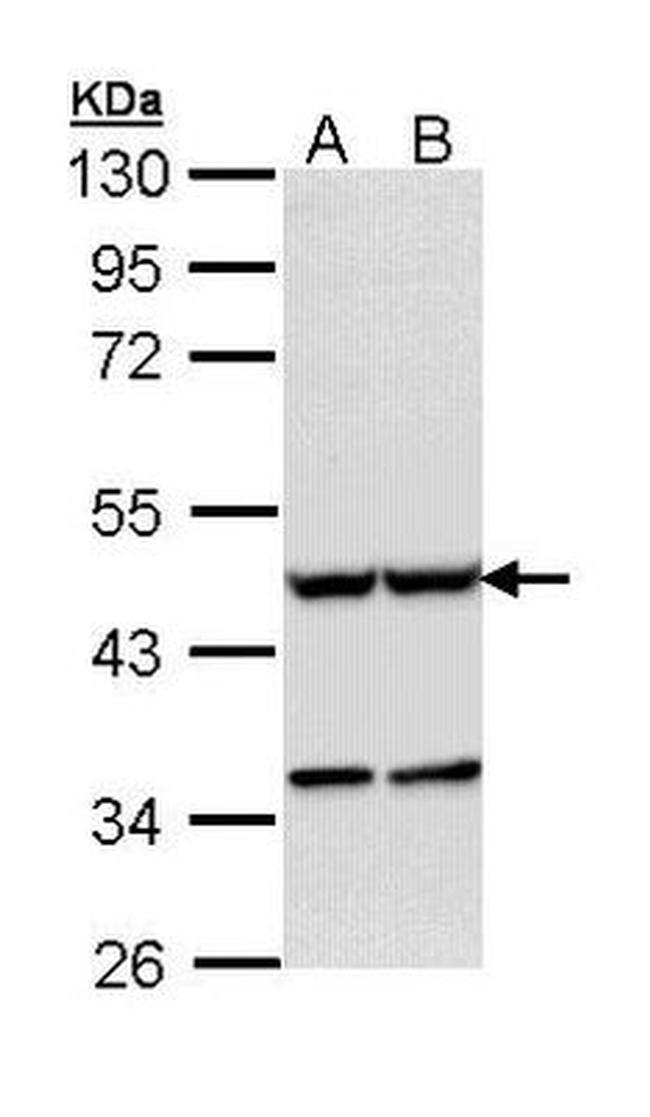 Actin Antibody in Western Blot (WB)