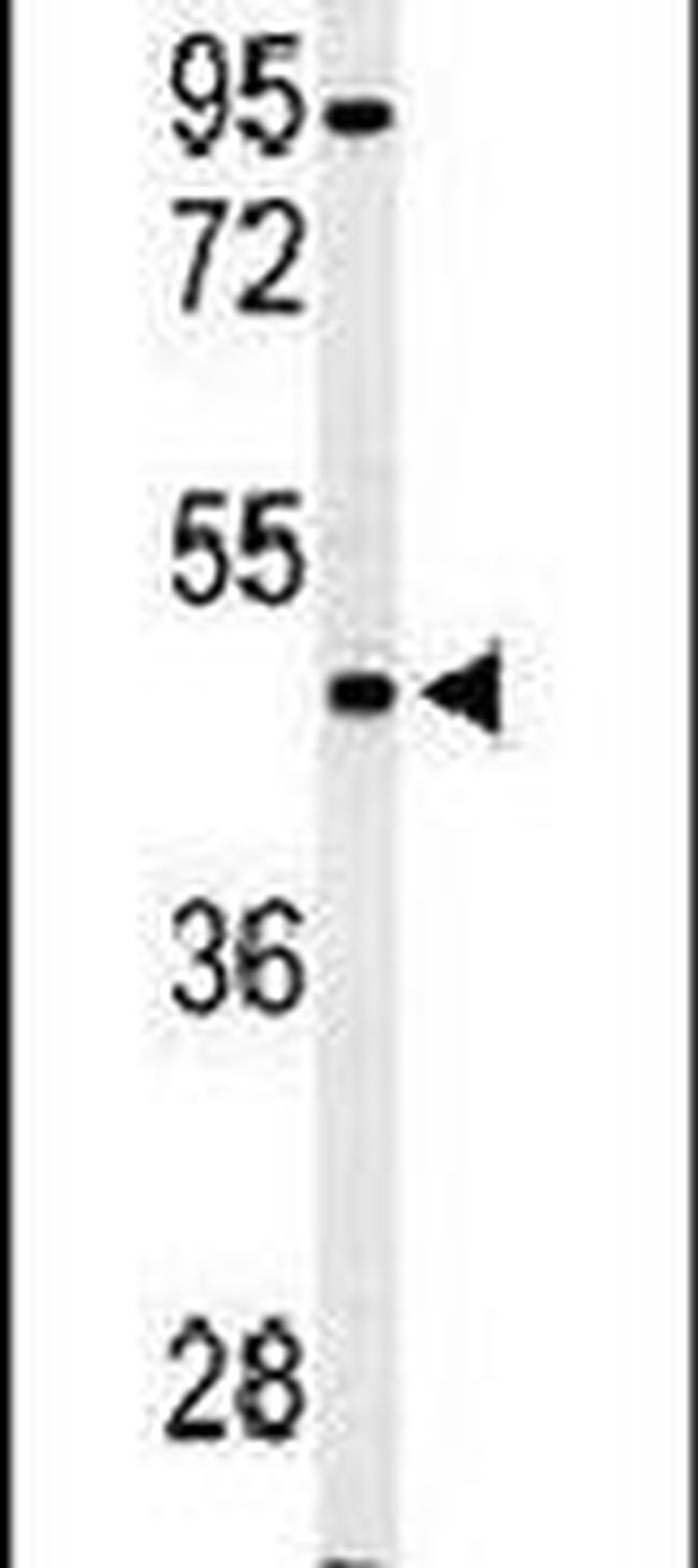 PFTK1 Antibody in Western Blot (WB)