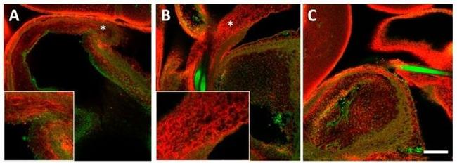 Collagen I Antibody in Immunohistochemistry (IHC)