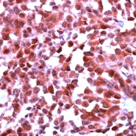 mGluR1 Antibody in Immunohistochemistry (IHC)