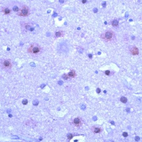 mGluR5 Antibody in Immunohistochemistry (IHC)