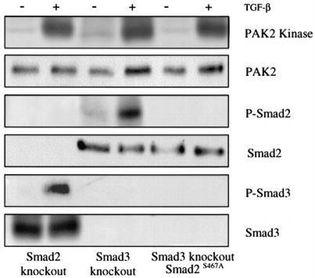 SMAD3 Antibody in Western Blot (WB)