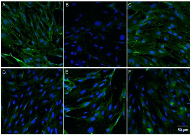 Claudin 5 Antibody in Immunocytochemistry (ICC/IF)
