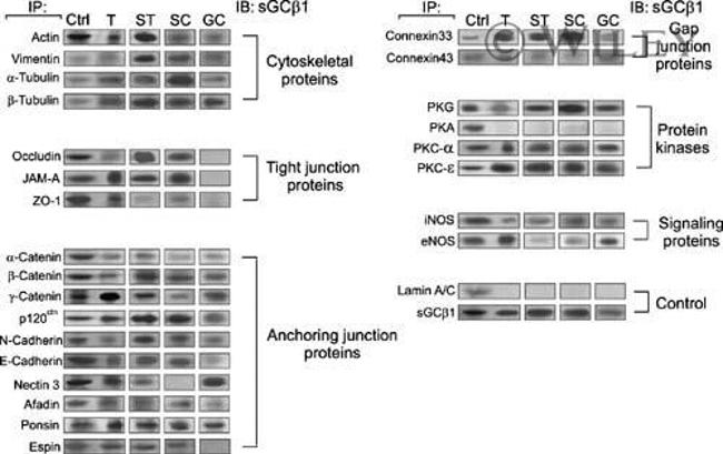 JAM-A (CD321) Antibody in Immunoprecipitation (IP)