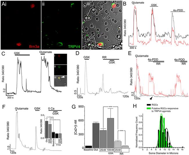 TRPV4 Antibody in Immunocytochemistry (ICC/IF)