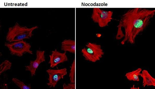 Phospho-Rb (Ser608) Antibody in Immunocytochemistry (ICC/IF)