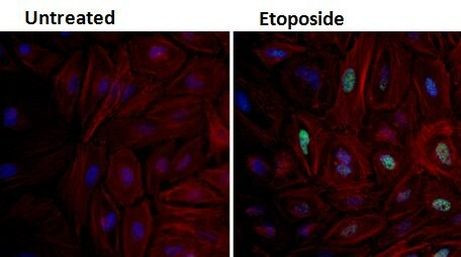 Phospho-p53 (Ser15) Antibody in Immunocytochemistry (ICC/IF)