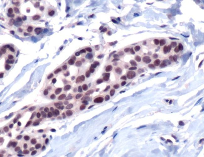 CBP Antibody in Immunohistochemistry (IHC)
